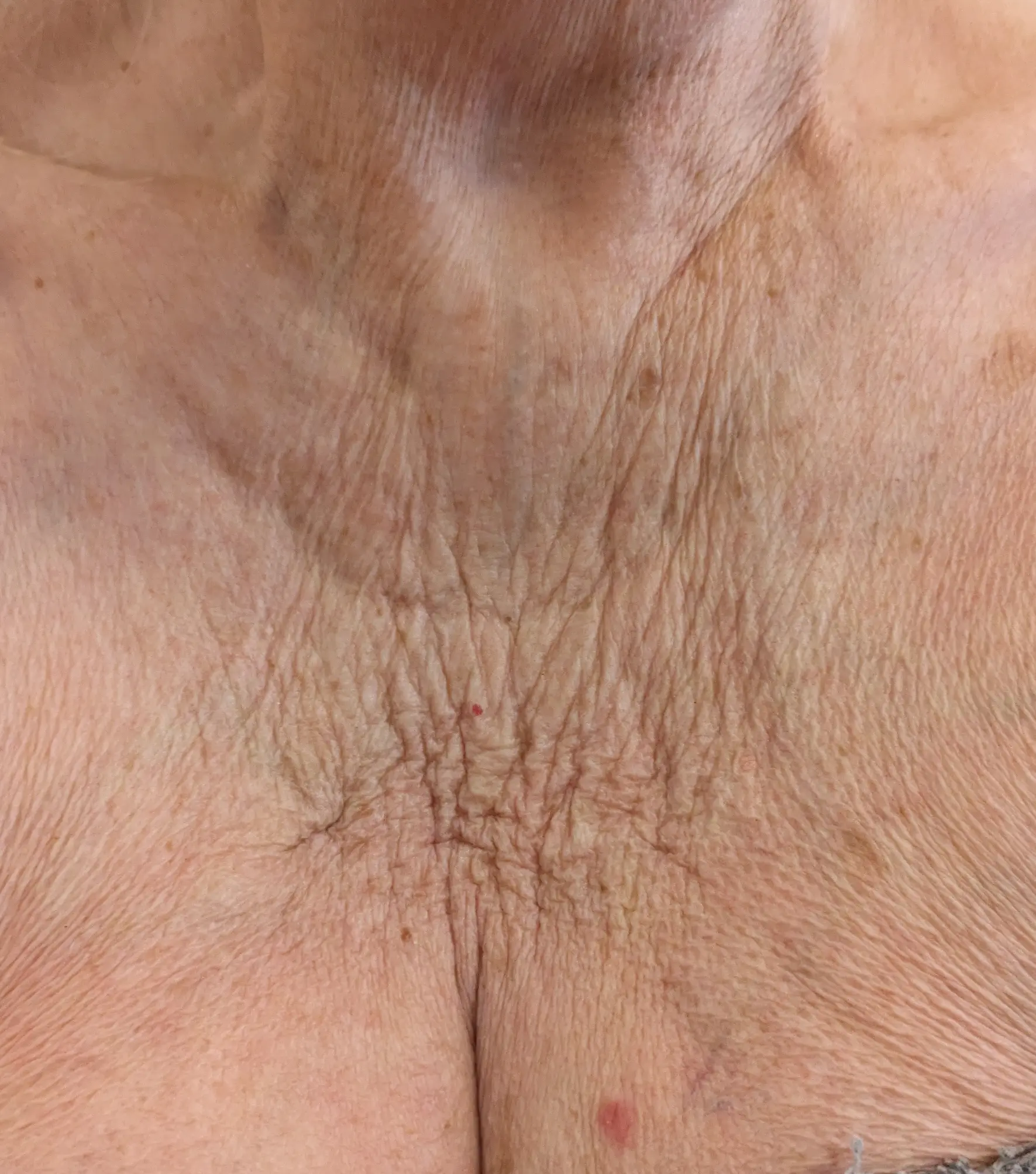 Zaffiro — Neck, Chest — przed