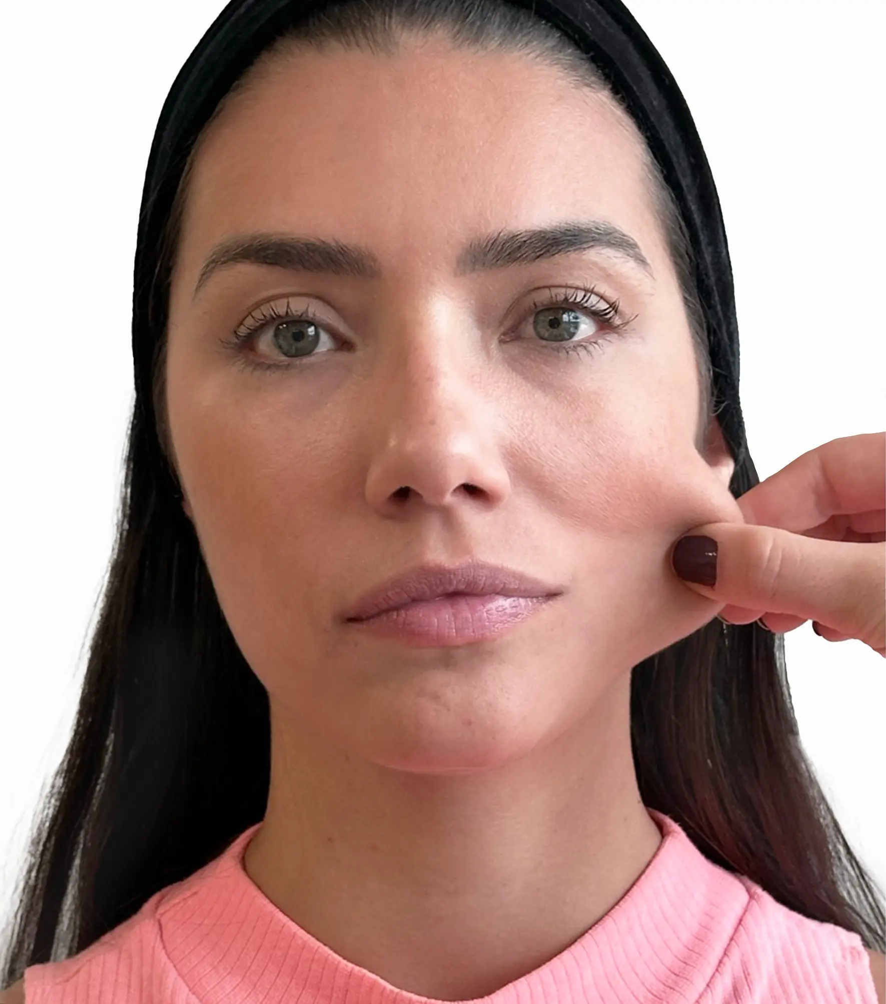 Zaffiro — Face, Prevention of sagging, Tissue flaccidity — przed